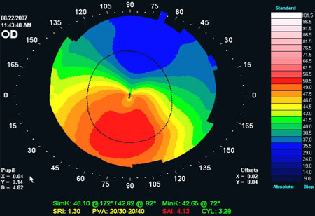Card EEG